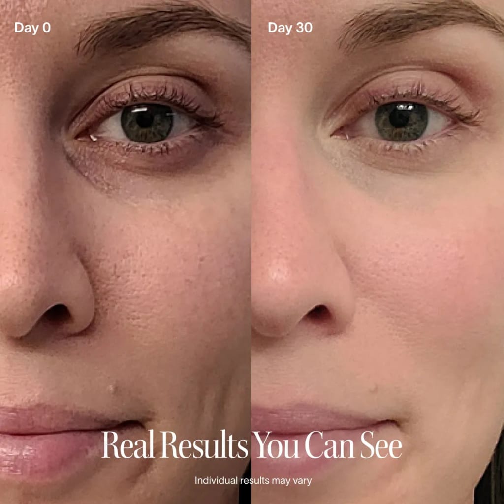 ClinicalGlow 4 in 1 Wand