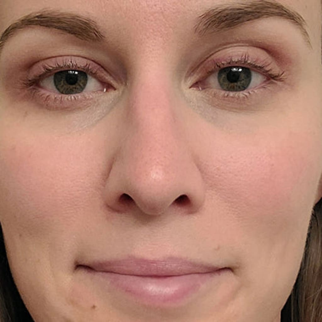 ClinicalGlow 4 in 1 Wand