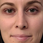 ClinicalGlow 4 in 1 Wand